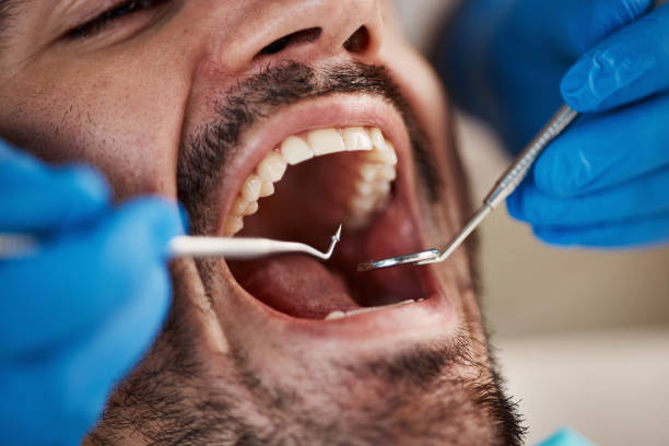 Best Dentist for Severe Toothache  in Lapeer, MI