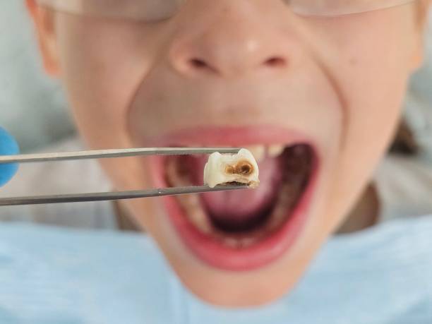 Best Chipped Tooth Repair Near Me  in Lapeer, MI